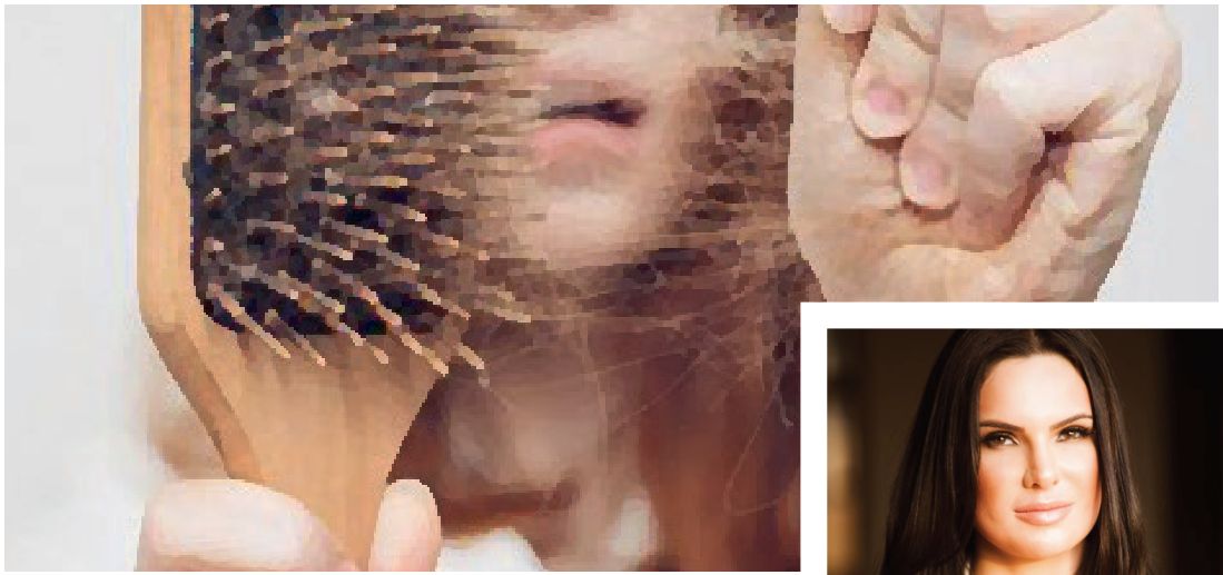 Queda de Cabelo